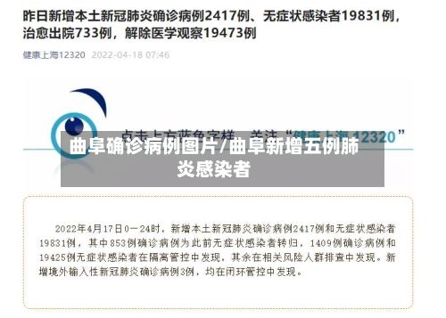 曲阜确诊病例图片/曲阜新增五例肺炎感染者-第3张图片