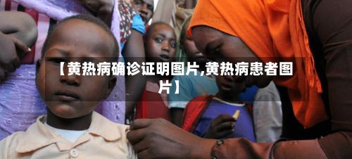 【黄热病确诊证明图片,黄热病患者图片】