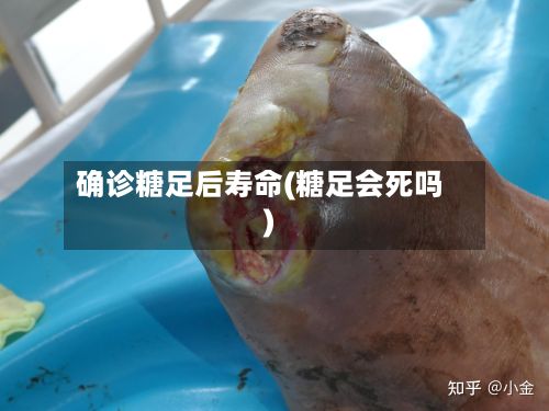 确诊糖足后寿命(糖足会死吗)-第1张图片