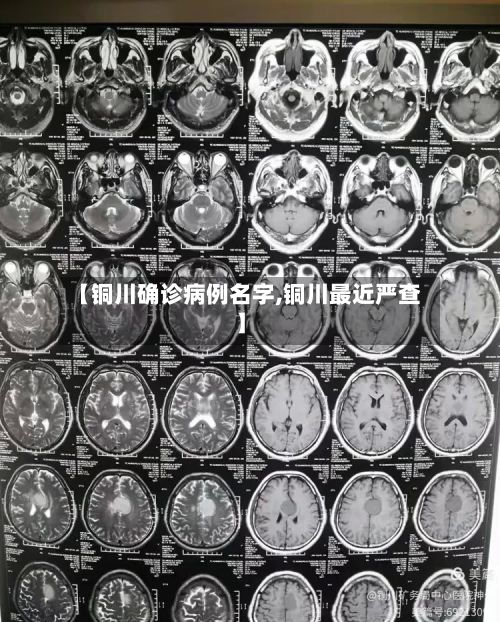 【铜川确诊病例名字,铜川最近严查】
