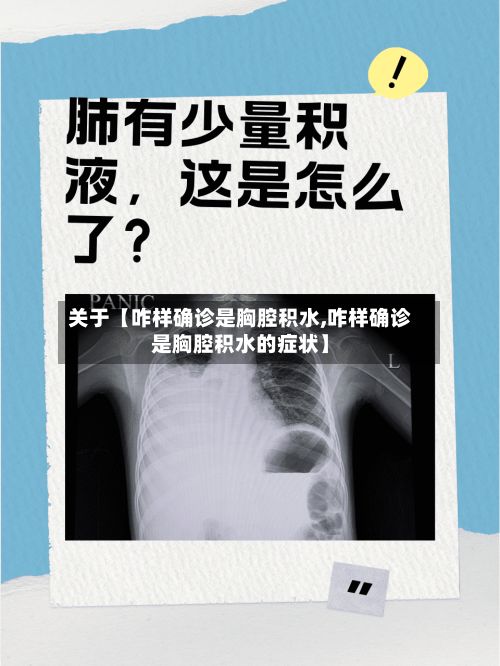 关于【咋样确诊是胸腔积水,咋样确诊是胸腔积水的症状】-第2张图片