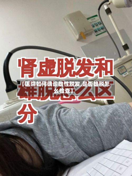 【医院如何确诊雄性脱发,是否雄脱怎么检查】-第2张图片